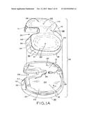 MOTION FACILITATING TIBIAL COMPONENTS FOR A KNEE PROSTHESIS diagram and image