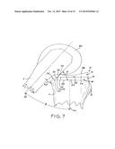 MOTION FACILITATING TIBIAL COMPONENTS FOR A KNEE PROSTHESIS diagram and image