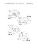 Latent Mobile Bearing For Prosthetic Device diagram and image