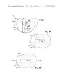 Latent Mobile Bearing For Prosthetic Device diagram and image