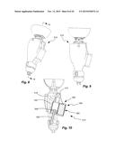 PROSTHETIC WITH VOICE COIL VALVE diagram and image