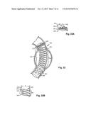 FLEXIBLE STENT GRAFT diagram and image