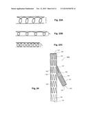 FLEXIBLE STENT GRAFT diagram and image