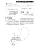 SATIATION DEVICES AND METHODS diagram and image