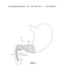 SATIATION DEVICES AND METHODS diagram and image