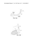 SATIATION DEVICES AND METHODS diagram and image