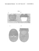 ONE PIECE OSTOMY POUCH ENHANCEMENTS diagram and image