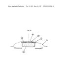 ONE PIECE OSTOMY POUCH ENHANCEMENTS diagram and image