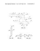 Lens Nucleus Chopper diagram and image