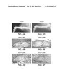 Methods For Bone Treatment By Modulating An Arachidonic Acid Metabolic or     Signaling Pathway diagram and image