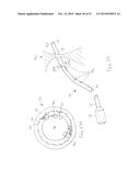 CATHETERS WITH LUBRICIOUS LININGS AND METHODS FOR MAKING AND USING THEM diagram and image