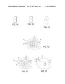 BONE IMPLANT AND SYSTEMS THAT CONTROLLABLY RELEASES SILVER diagram and image