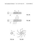 BONE IMPLANT AND SYSTEMS THAT CONTROLLABLY RELEASES SILVER diagram and image