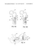 BONE IMPLANT AND SYSTEMS THAT CONTROLLABLY RELEASES SILVER diagram and image