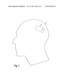 IMPLANTABLE SYSTEM ENABLING RESPONSIVE THERAPY FOR PAIN diagram and image