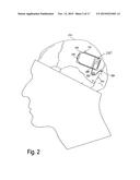 IMPLANTABLE SYSTEM ENABLING RESPONSIVE THERAPY FOR PAIN diagram and image