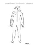 IMPLANTABLE SYSTEM ENABLING RESPONSIVE THERAPY FOR PAIN diagram and image