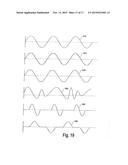 IMPLANTABLE SYSTEM ENABLING RESPONSIVE THERAPY FOR PAIN diagram and image