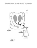 RELIABLE READINESS INDICATION FOR A WEARABLE DEFIBRILATOR diagram and image