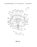 METHOD AND APPARATUS FOR THE TREATMENT OF TISSUE diagram and image