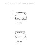 METHOD AND APPARATUS FOR THE TREATMENT OF TISSUE diagram and image