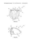 GOLF CLUB WITH MULTI-COMPONENT CONSTRUCTION diagram and image