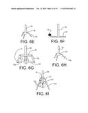 STRIKE ZONE DETECTION DEVICE diagram and image