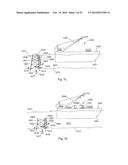 Laser Systems and Apparatus for the Removal of Structures diagram and image