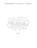 Laser Systems and Apparatus for the Removal of Structures diagram and image