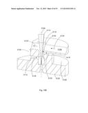 Laser Systems and Apparatus for the Removal of Structures diagram and image