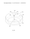 Laser Systems and Apparatus for the Removal of Structures diagram and image