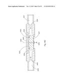 Laser Systems and Apparatus for the Removal of Structures diagram and image