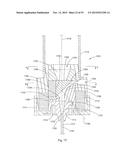 Laser Systems and Apparatus for the Removal of Structures diagram and image