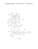 Laser Systems and Apparatus for the Removal of Structures diagram and image