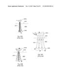 Laser Systems and Apparatus for the Removal of Structures diagram and image