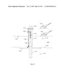 Laser Systems and Apparatus for the Removal of Structures diagram and image