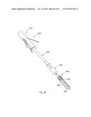 Laser Systems and Apparatus for the Removal of Structures diagram and image