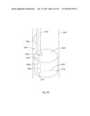 Laser Systems and Apparatus for the Removal of Structures diagram and image