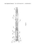 Laser Systems and Apparatus for the Removal of Structures diagram and image