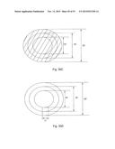 Laser Systems and Apparatus for the Removal of Structures diagram and image