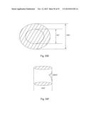 Laser Systems and Apparatus for the Removal of Structures diagram and image