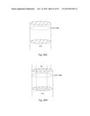 Laser Systems and Apparatus for the Removal of Structures diagram and image