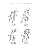 Torque Rod Bracket for Mounting a Torque Rod on a Housing of a Tag Axle diagram and image