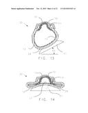 Foam Tire Flap for Low Pressure Applications diagram and image