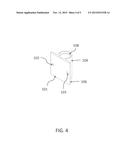 Weight Distribution System Round Bar Storage Bracket System diagram and image