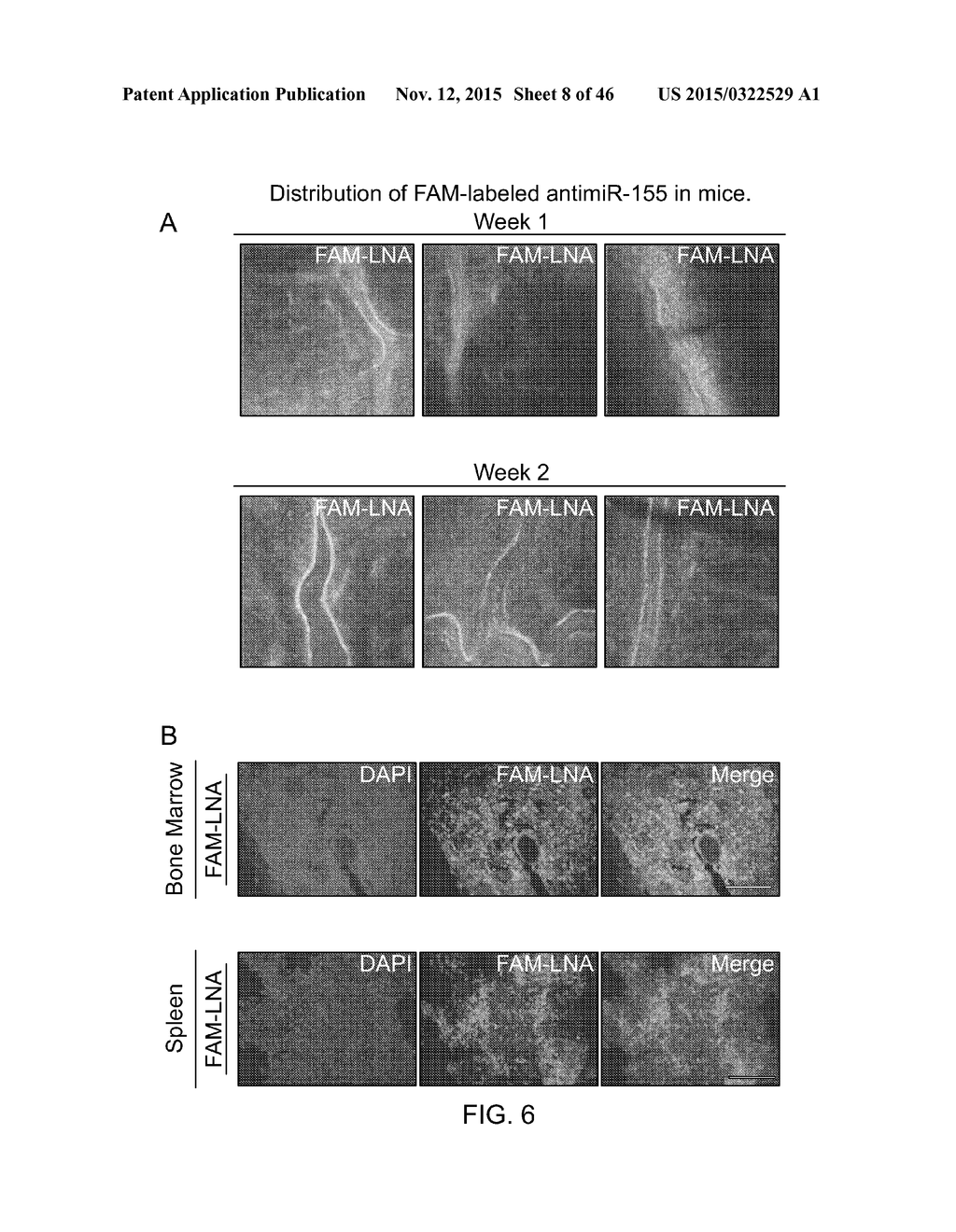 Compositions And Methods For Diagnosis, Prognosis And Treatment Of     Hematological Malignanicies - diagram, schematic, and image 09