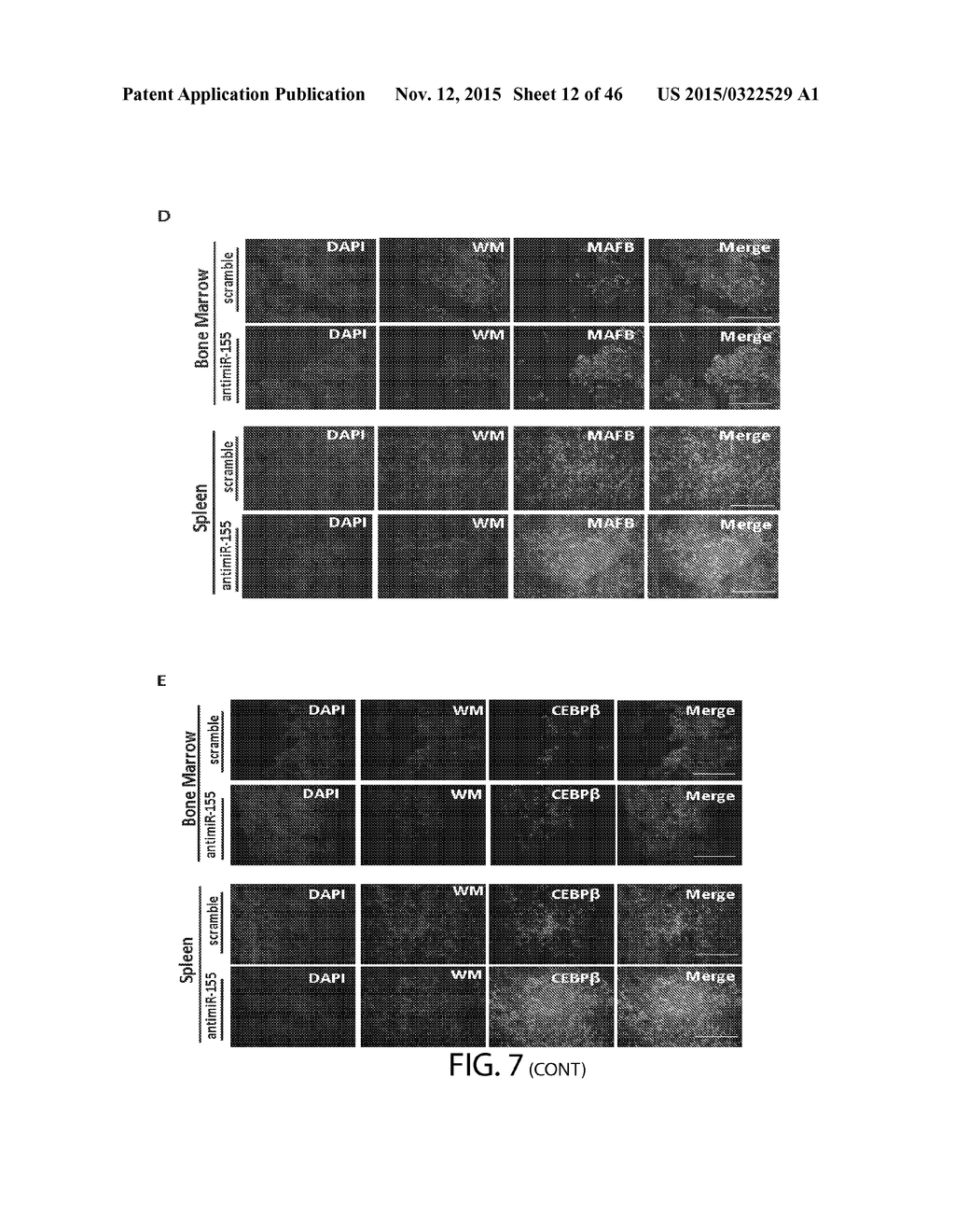 Compositions And Methods For Diagnosis, Prognosis And Treatment Of     Hematological Malignanicies - diagram, schematic, and image 13