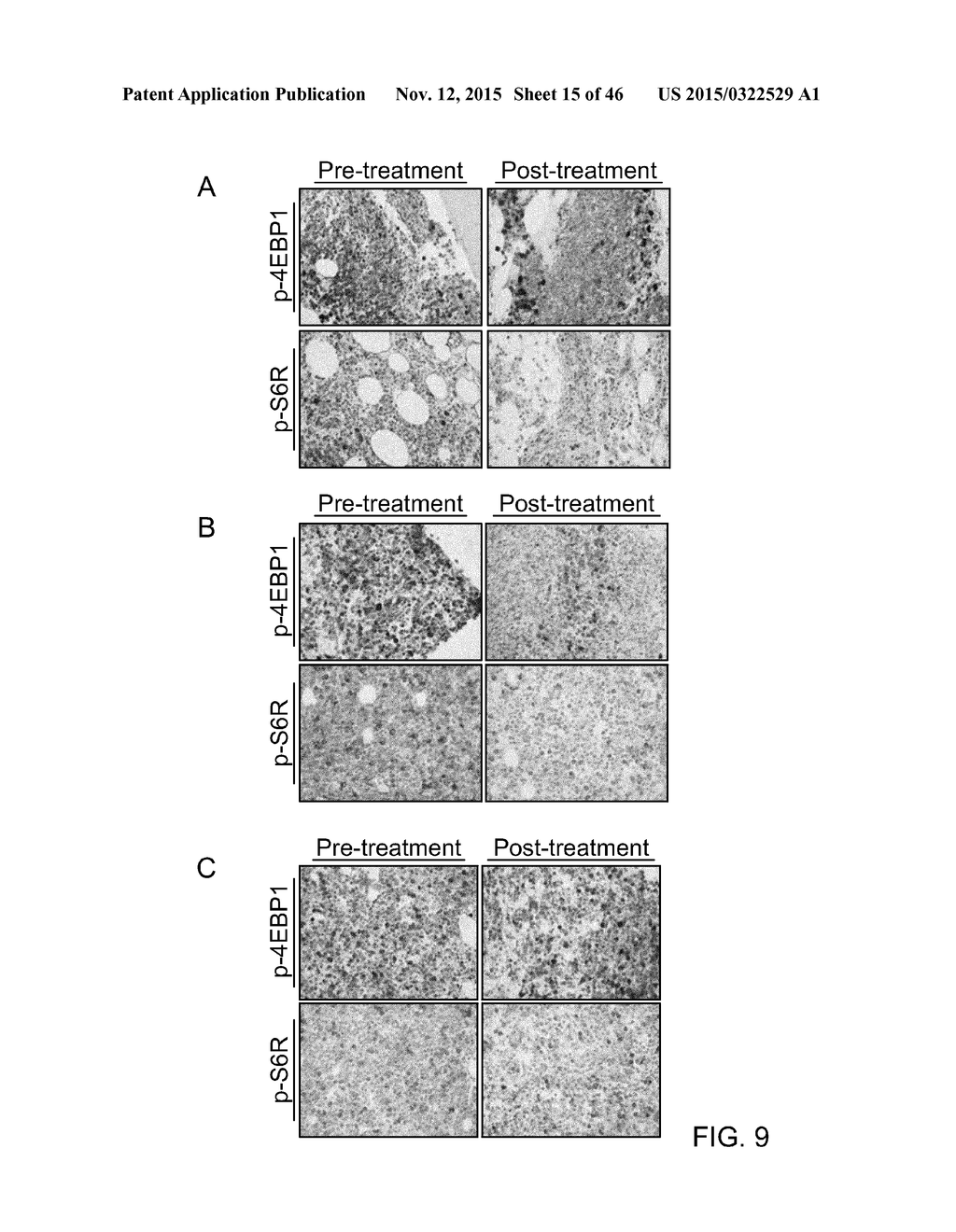 Compositions And Methods For Diagnosis, Prognosis And Treatment Of     Hematological Malignanicies - diagram, schematic, and image 16