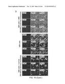 Compositions And Methods For Diagnosis, Prognosis And Treatment Of     Hematological Malignanicies diagram and image
