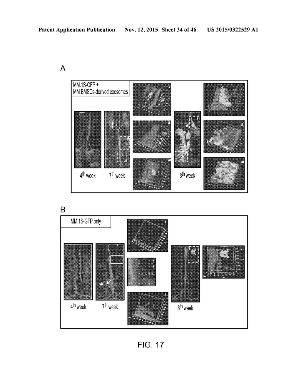 Compositions And Methods For Diagnosis, Prognosis And Treatment Of     Hematological Malignanicies - diagram, schematic, and image 35